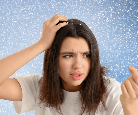 Why Your Partner Never Flakes—Even Though You Use the Same Shampoo